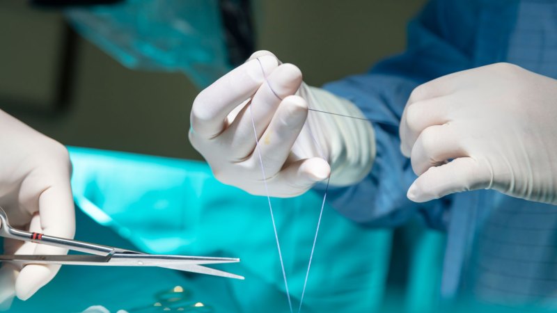 A surgeon holds a suture in their hands, while another cuts the suture with scissors.